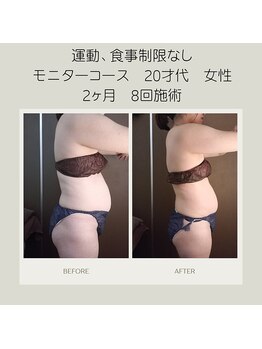 キセキ KISEKI リラクゼーション/最新×最強マシンでダイエット