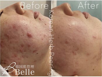 ベル 本厚木(Belle)