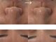 シェリー(cherie)の写真/【桜山/毛穴根本改善】30歳からの詰まり・開き・たるみ毛穴を徹底洗浄。敏感肌でも叶う毛穴レス艶肌へ