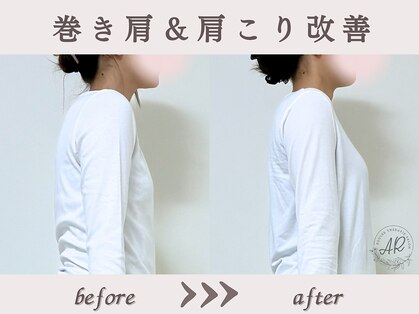 エーアール(AR)の写真