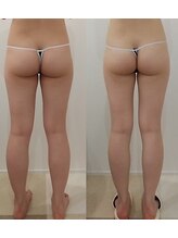 クレール アオヤマ(CLAIRE AOYAMA)/【4回】小尻＆スラっと美脚