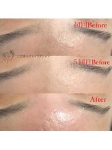 エマ(emma)/お鼻だけではありません