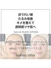 サロン ド ブラン アオヤマ(Salon de BLANC AOYAMA)/BIOPHYTO×韓国美容機器ソノケア