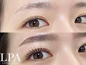 レピア JR和歌山駅前店/韓国式LEPIA Before&Aｆter