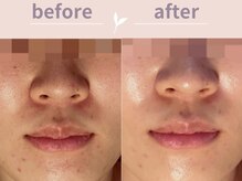 アール(R)/１度でこのツヤ！