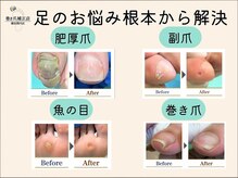 巻き爪補正店 横浜関内店