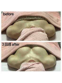 エジュール(EJURE)/ミラクルバスト・ブライダル