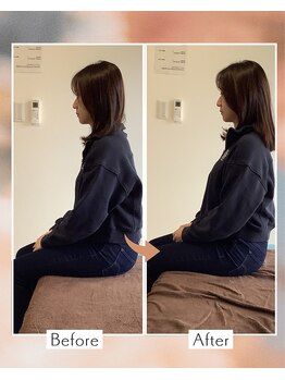 藤沢南口整体サロン/20代女性　肩が正しい位置へ！