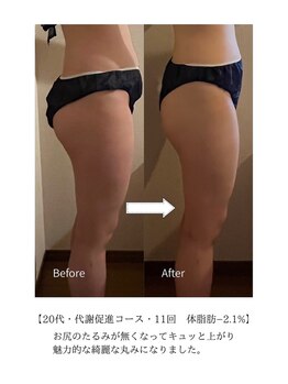 ヨサパーク スリー 西日暮里(YOSA PARK three)/20代 代謝促進コース 11回