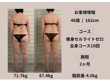 ハナメ(HANAME)/痩身引き締めコース