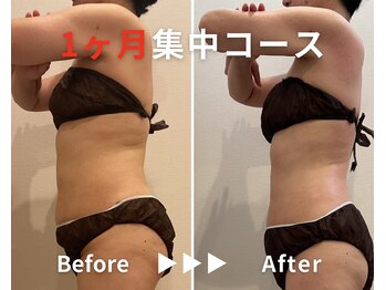 エピデリ 福岡大濠(EPI de RIZ)/【痩身/ダイエット】1ヶ月集中