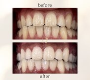 ルセホワイト 室蘭登別(LUCE WHITE)