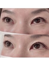 リボーテ(Reboaute)/アップフォースリフト