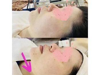 トム トム/フェイスライン