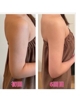 オードリリー(eau de Lily)/魅せる上半身へ！