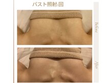 マオ(mao)/バストアップ☆バストケア