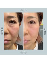 スプレール 水戸店/ExoLif（エクソリフト）