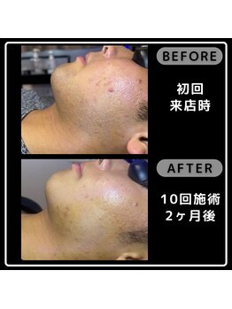 レイズ(Reyz)/
