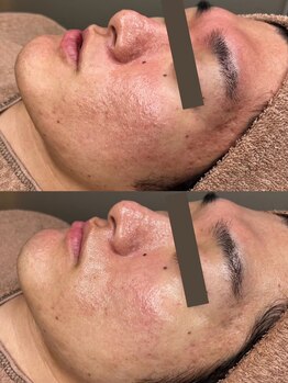 サロン イロハ(salon iroha)/ララピール