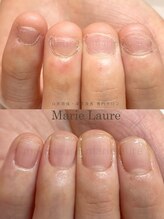 マリーロール 淀屋橋本店(Marie Laure)/自爪育成/深爪矯正/ネイルケア