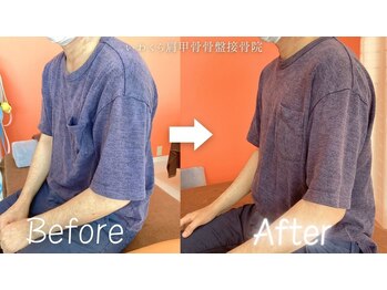 いわくら肩甲骨 骨盤接骨院BTG 一宮千秋/猫背矯正・肩甲骨はがし 2