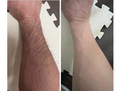 サロンストロベリームーン(Salon Strawberry Moon)の写真