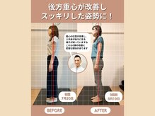 スペックフィジカルコンディショニング(SPECフィジカルコンディショニング)/40代女性/姿勢ビフォーアフター