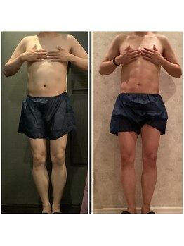 プラチナアース つくば店(Platinum earth)/痩身ビフォーアフター