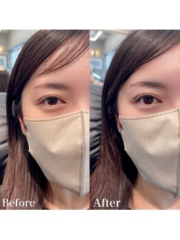 トーキョーパートナーズ(TOKYO PARTNERS)/まつげパーマ Before＆After