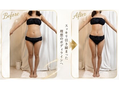 アーラ アンド べレア(ALA & Bellea)の写真