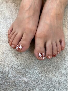 ラモネイル(RamoNAIL)/