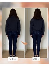 藤沢南口整体サロン/20代女性　骨盤を締めました！