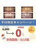 【平日&20名様限定】美白ホワイトニング15分×2（30分照射）お試し¥0★