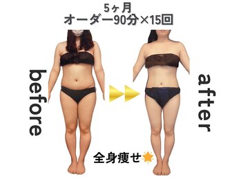 ジュリアン 千葉店(Julien)の写真/気になる下半身のセル脂肪を徹底ケア◎プロの施術と最適マシンで脂肪を撃退!美脚&美尻をGET♪