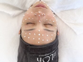 シュリ(Shri)の写真/【トータルビューティが叶う☆】豊富なメニューからお悩みに合わせて提案！パッチリとした理想の目元へ♪