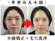 ブプラ 六本松店(BUPURA)の写真