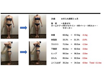 クリアー(clear)/ダイエットビフォーアフター