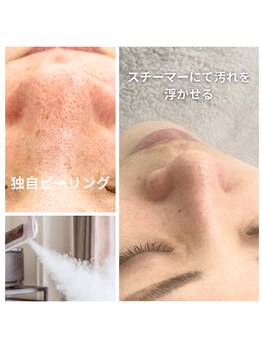 煌(kirameki)/浮き出し独自ピーリング