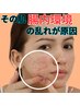 【細胞レベルの温活】体の中から温め憧れの美肌を手に入れたい方必見！¥5,500