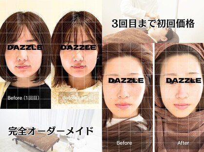 ダズル(DAZZLE)の写真