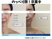 お顔の研究所/ビフォーアフター写真♪