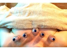 プルフローラ(pluflora)/デコルテカッピング