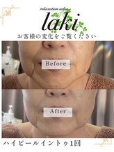 リラクゼーションサロン ラキ(laki)/