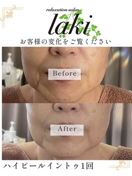 リラクゼーションサロン ラキ(laki)/