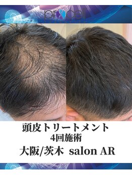 メンズサロンアール(AR)/プロセルセラピーズ
