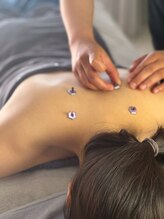 シミケアサロンShin/美容鍼灸