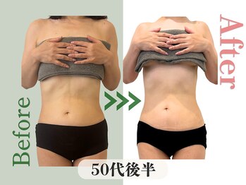 アムール(Amour)/洋服ワンサイズダウン！50代