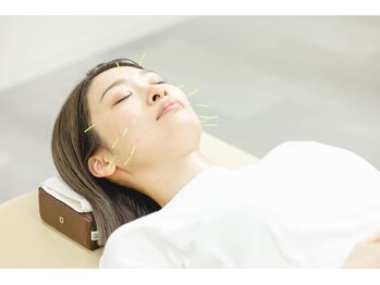 F-nine具志川整骨院・鍼灸院の写真/美容認定された有資格者による【本格美容鍼灸￥2200】身体の全部のバランスを整える満足度No.1コース☆