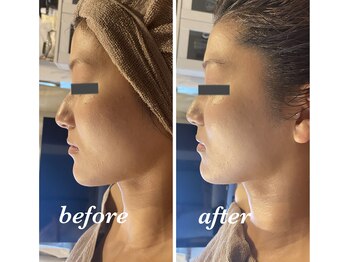 アンドエラ(&ERA)/リアボーテタラソトリートメント