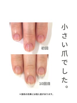 最強ネイルケア
